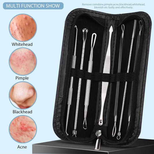 Blackhead Remover Kit - 5-Piece Pimple & Comedone Extractor Tools for Facial Skincare